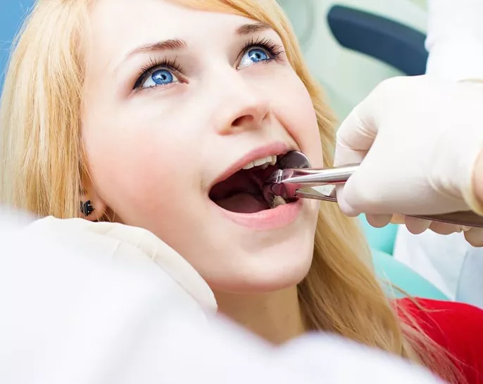 Dental Extraction