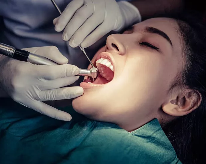 Root Canal Treatment